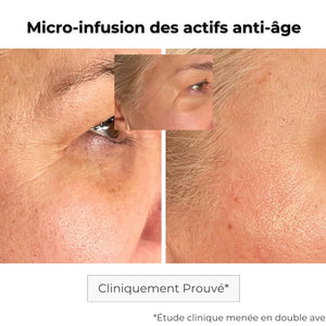 Patch anti-âge microstructure avant-après — effet liftant immédiat et durable